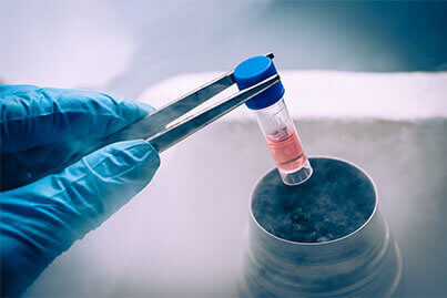 cryopreservation-1